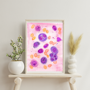 Multiple Myeloma Histopathology Art