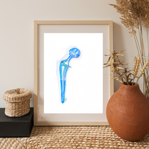 Hip Implant Watercolor Art Print