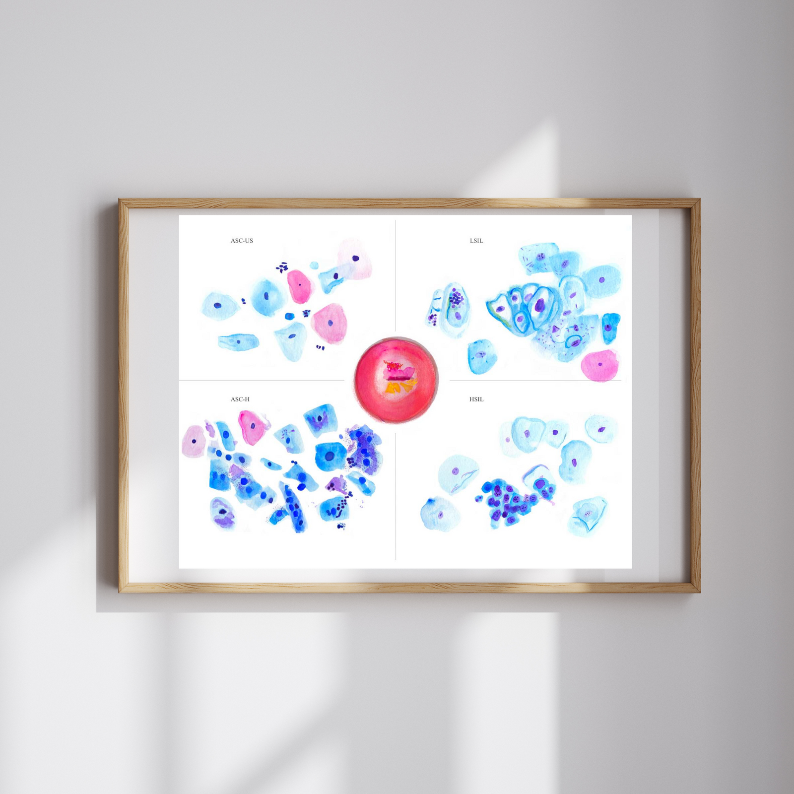 Cervix Cytology Art Print