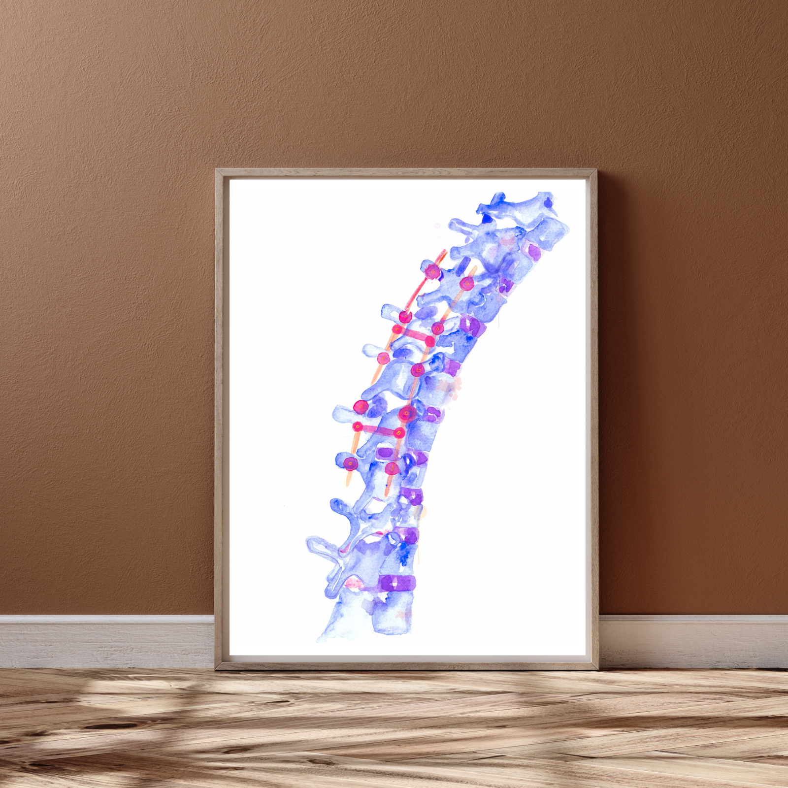 Spine Surgery Art Print