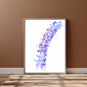 Spine Surgery Art Print