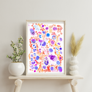 Mastocytosis Bone Marrow Smear Watercolor Art Print