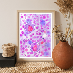 Hodgkin Lymphoma Watercolor Art Print