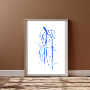 Popliteo-tibial Angiography Art Print