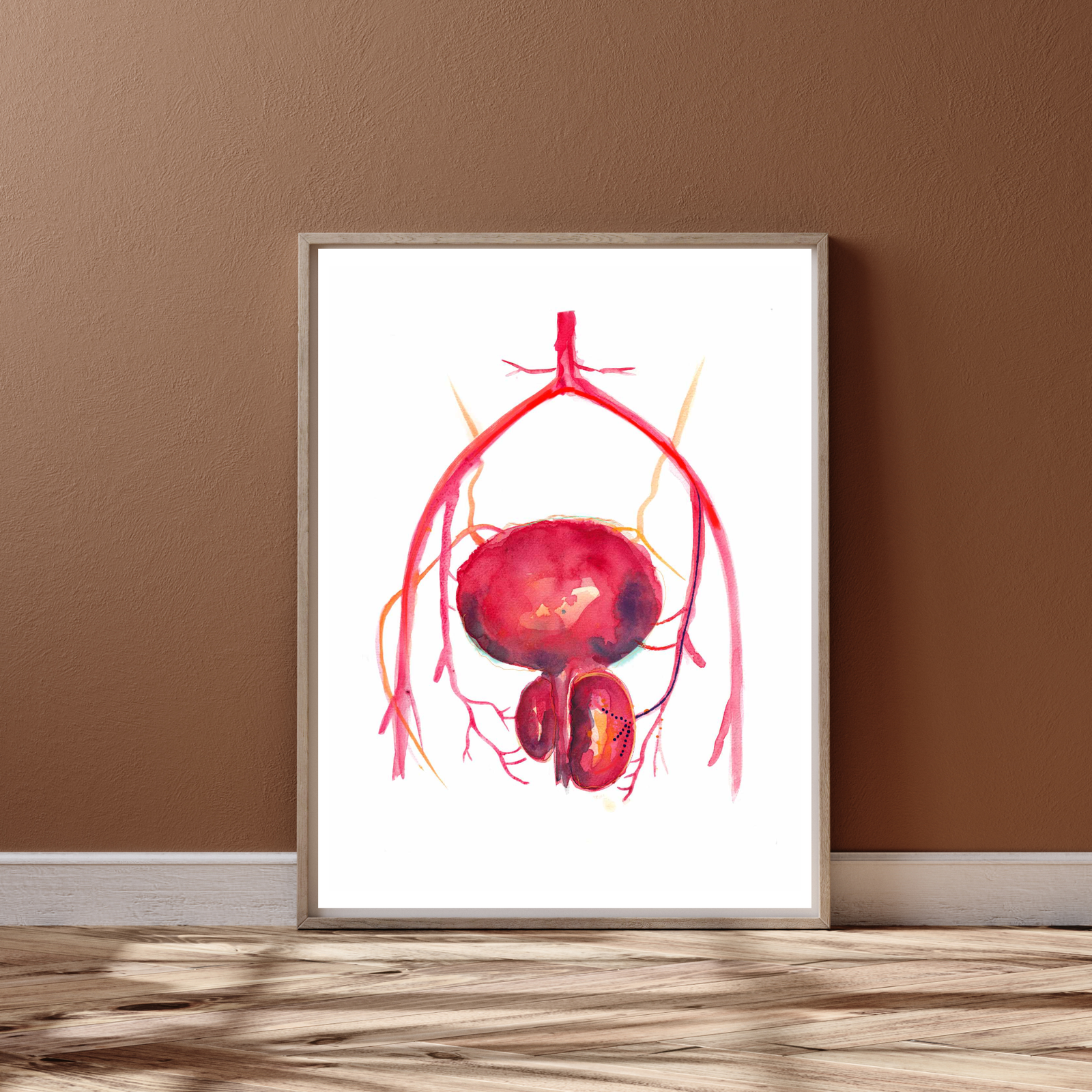 Prostatic Artery Embolization Art