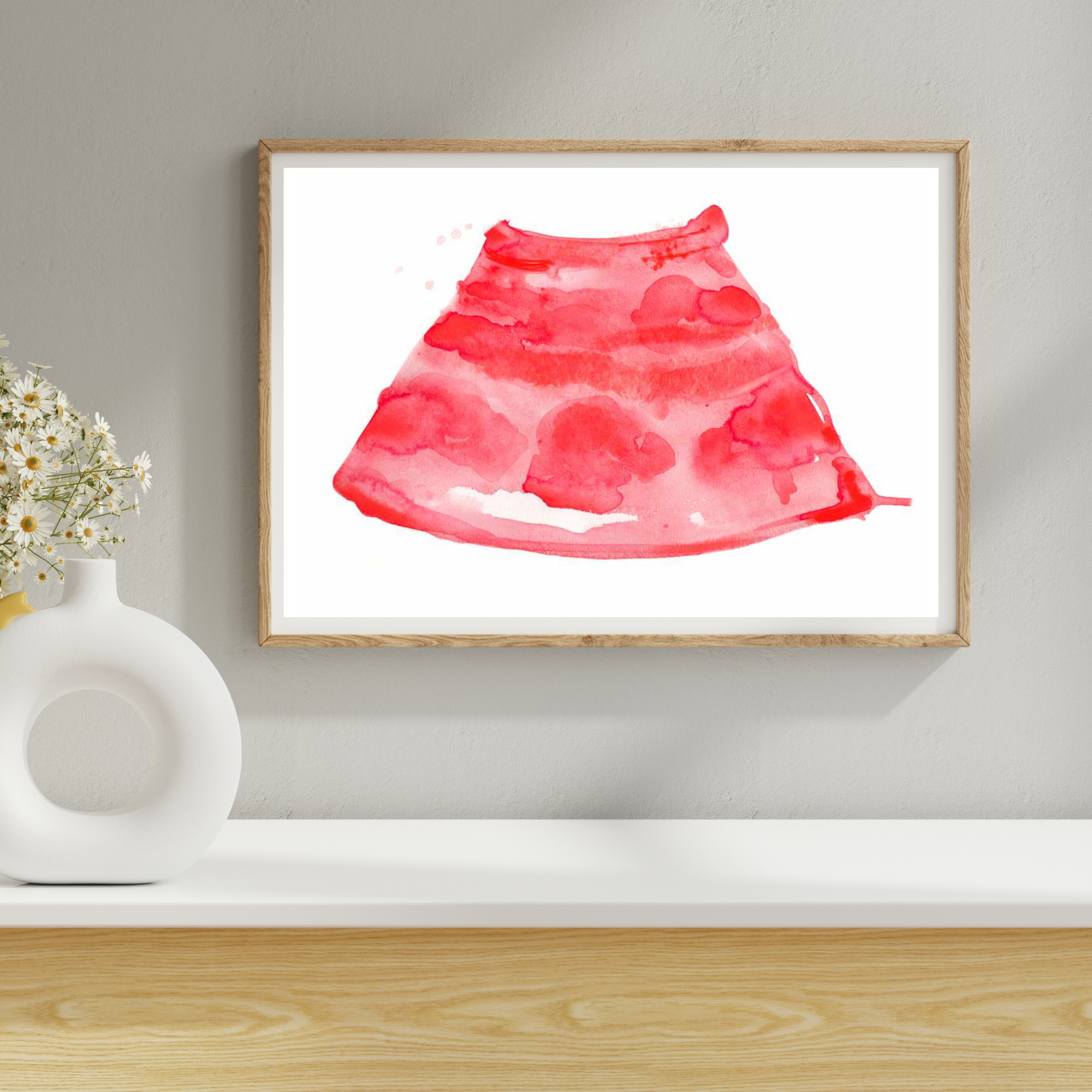 Anesthesia - Ultrasound-Guided Infraclavicular Brachial Plexus Nerve Block