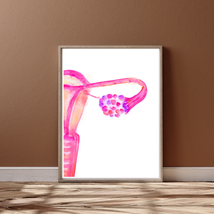 Polyendocrine Metabolic Ovarian Syndrome PMOS - PCOS Abstract Uterus Anatomy Art Print