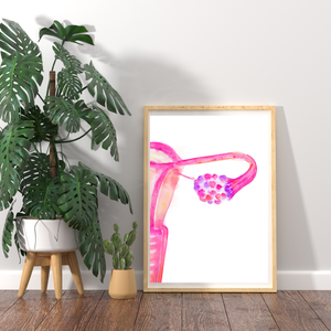 Polyendocrine Metabolic Ovarian Syndrome PMOS - PCOS Abstract Uterus Anatomy Art Print