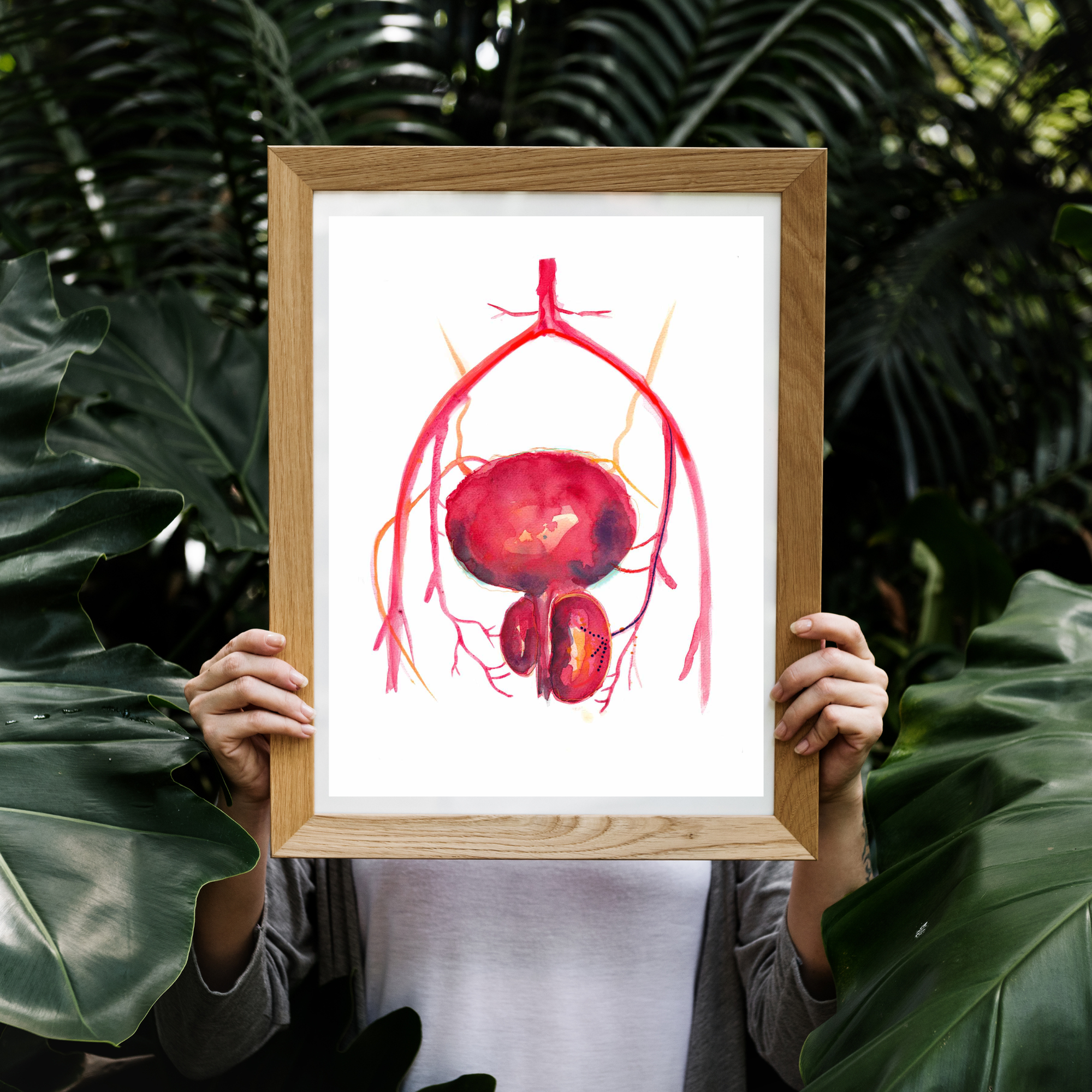 Prostatic Artery Embolization Art