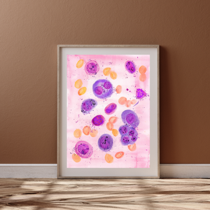 Multiple Myeloma Histopathology Art