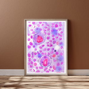 Hodgkin Lymphoma Watercolor Art Print