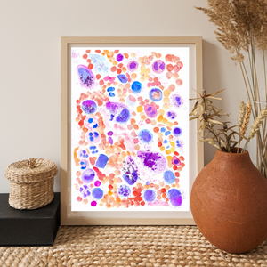 Mastocytosis Bone Marrow Smear Watercolor Art Print