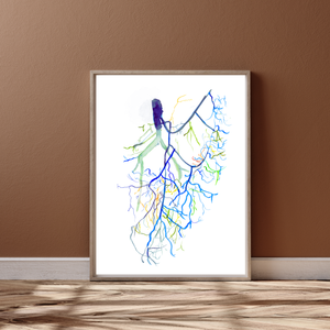 Mesenteric Arteries Angiogram