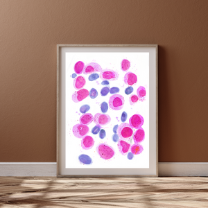 Acute Myeloid Leukemia Art