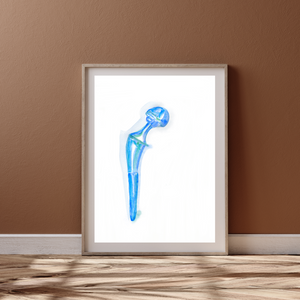 Hip Implant Watercolor Art Print