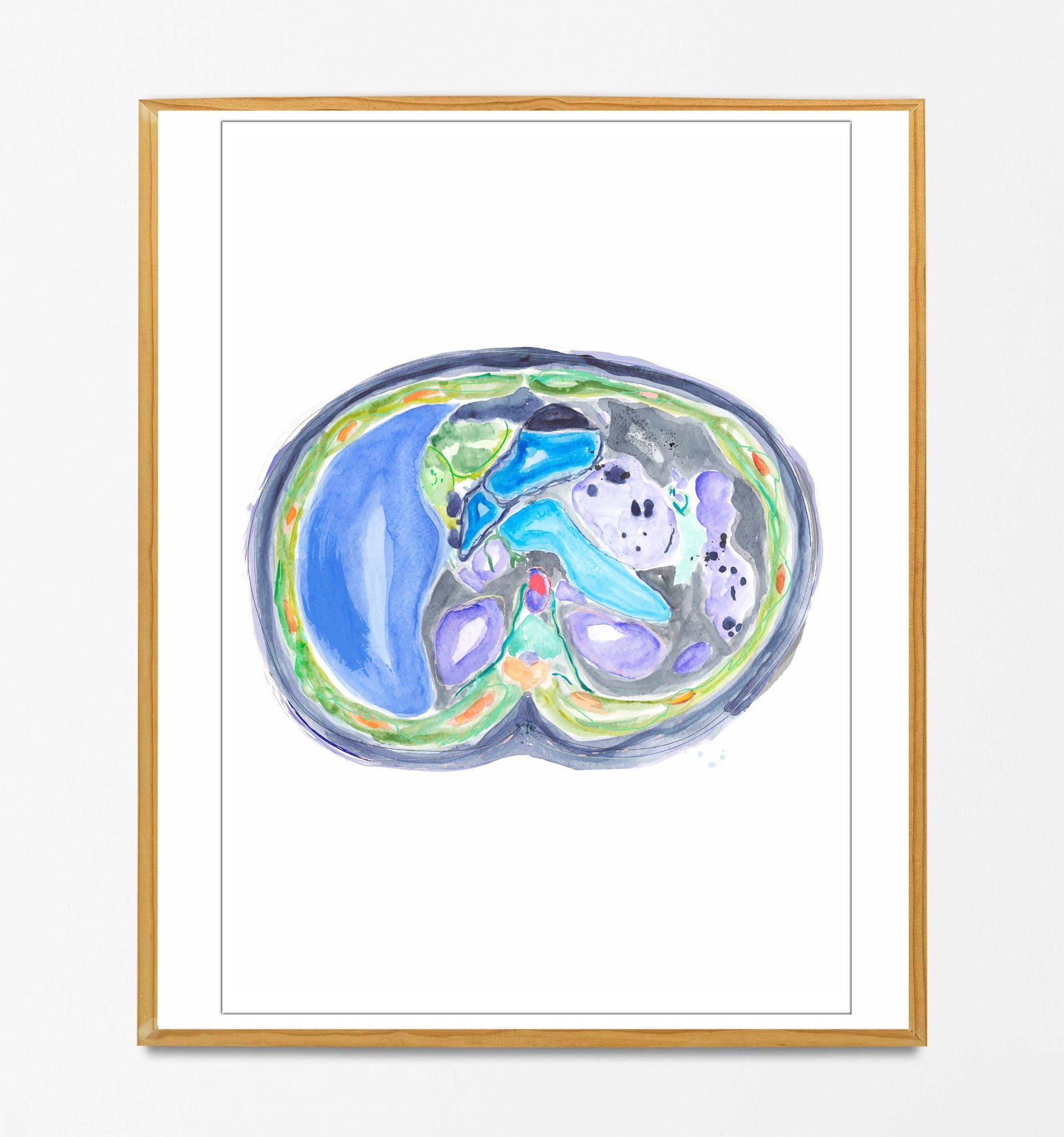 Abdominal CT Scan Cross Section Radiology Gastroenterology and Surgery Artwork