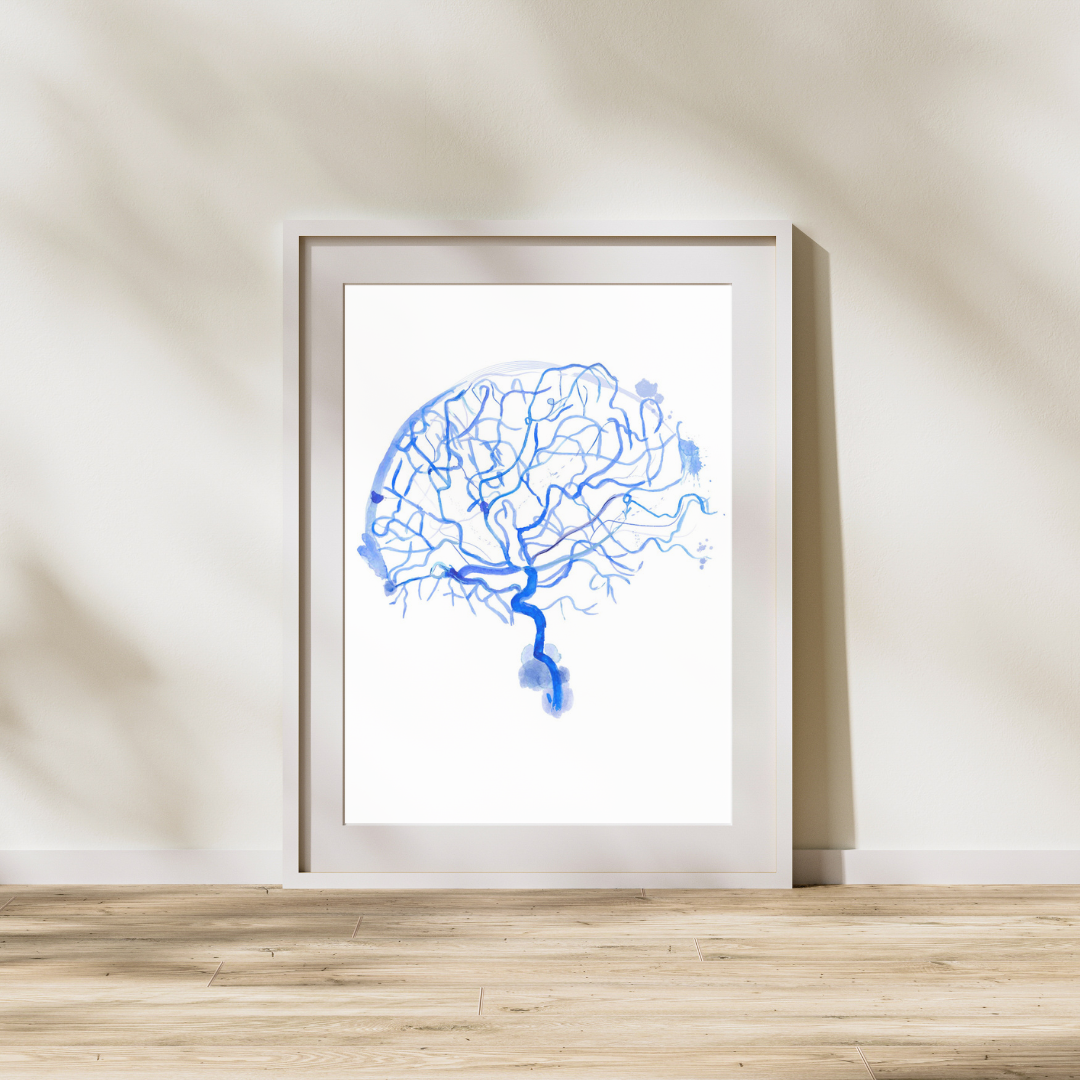 cerebral angiography art print
