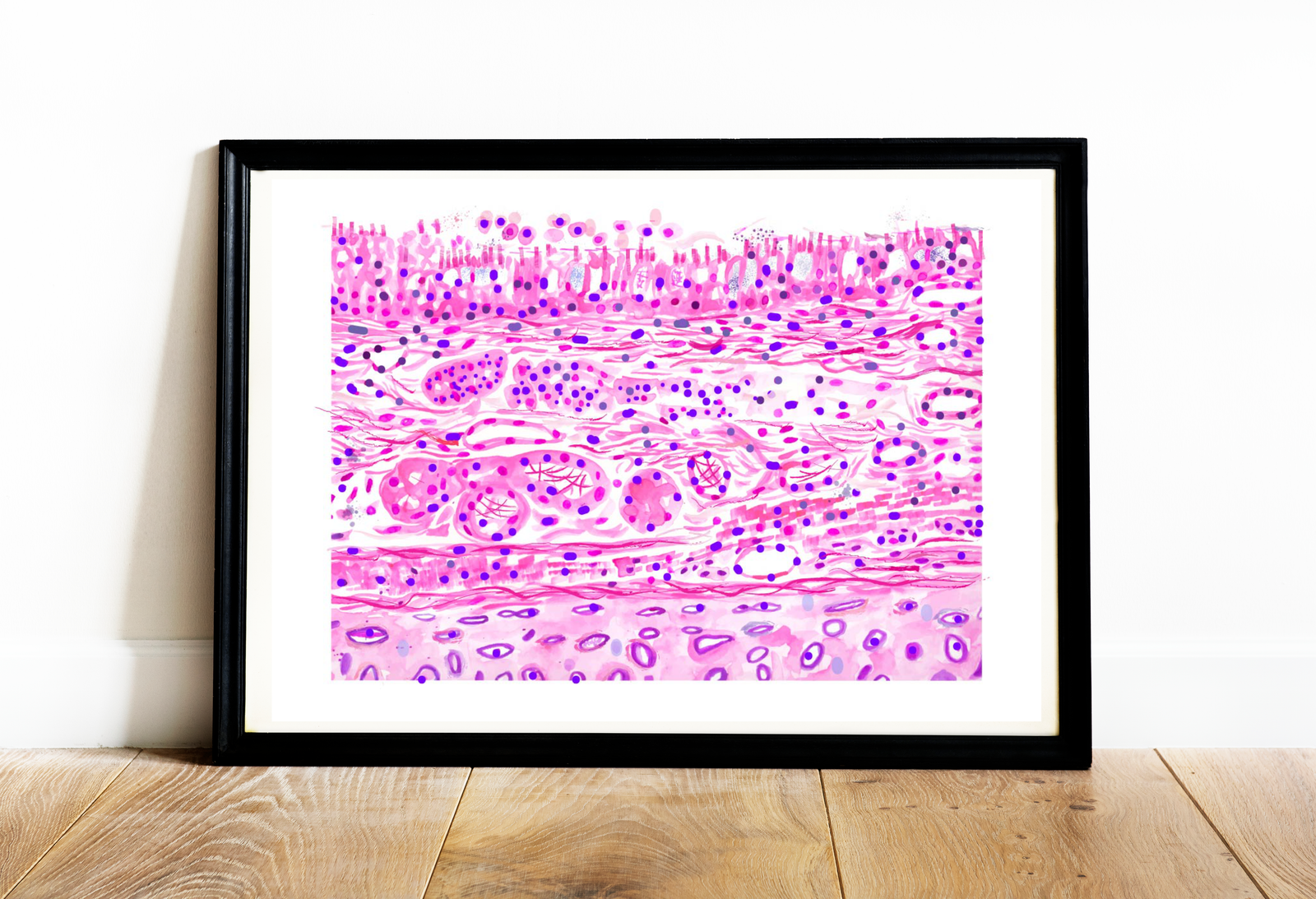 Bronchial Wall Histopathology Art