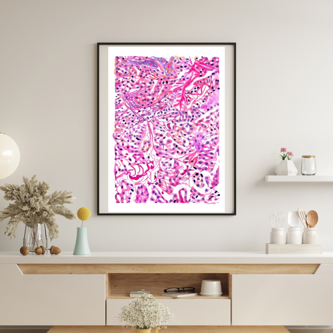 pancreas cancer awareness