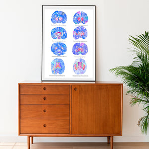Brain Sections Anatomy Art Print