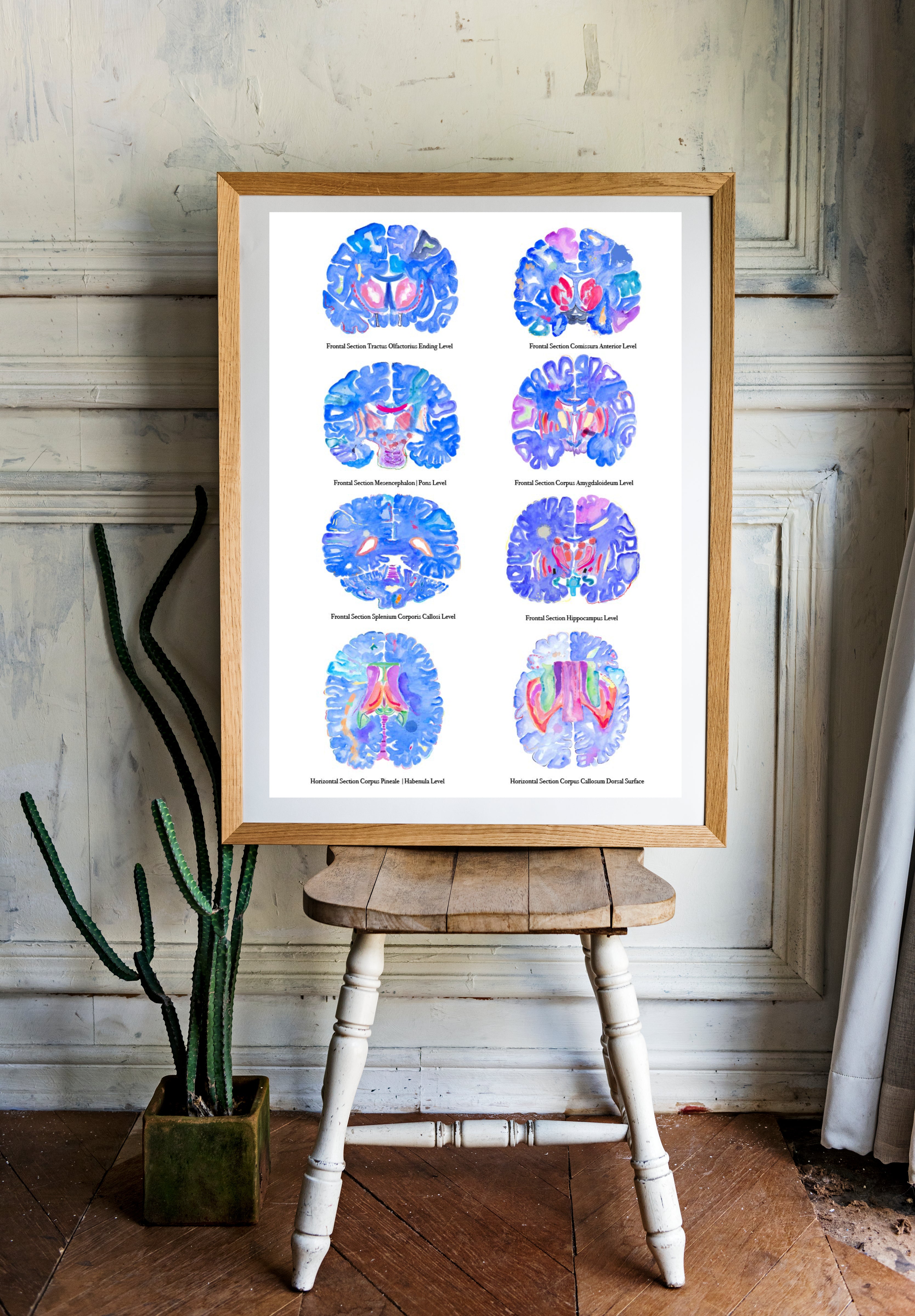Brain Sections Anatomy Art Print - medpapers