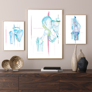 Orthopedic Surgery Artwork Set of Three: Knee, Shoulder and Hip Arthroplasty Print