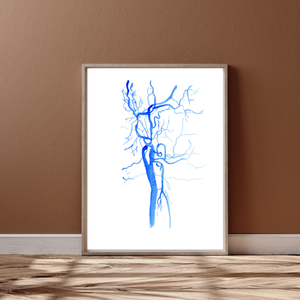 Carotid Angiography Post Stenting Watercolor Art Print