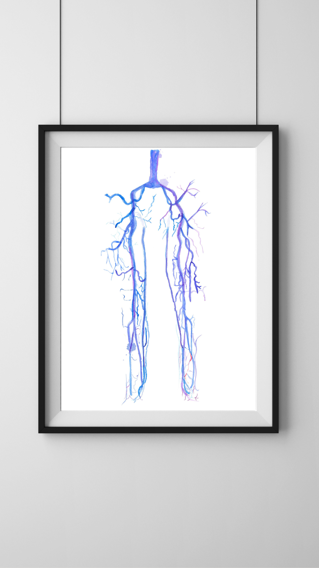 Lower Limb CTA Watercolor Art Print