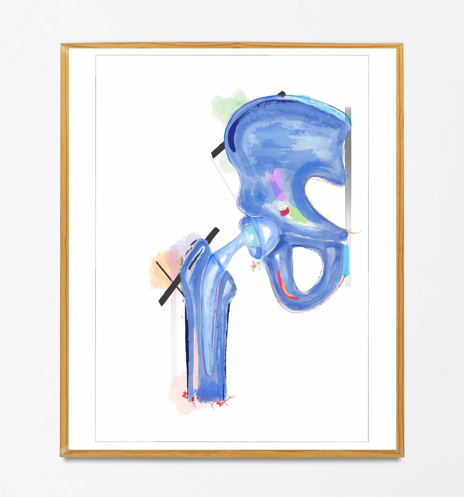 orthopedic surgery print
