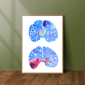 neurosurgery watercolor art