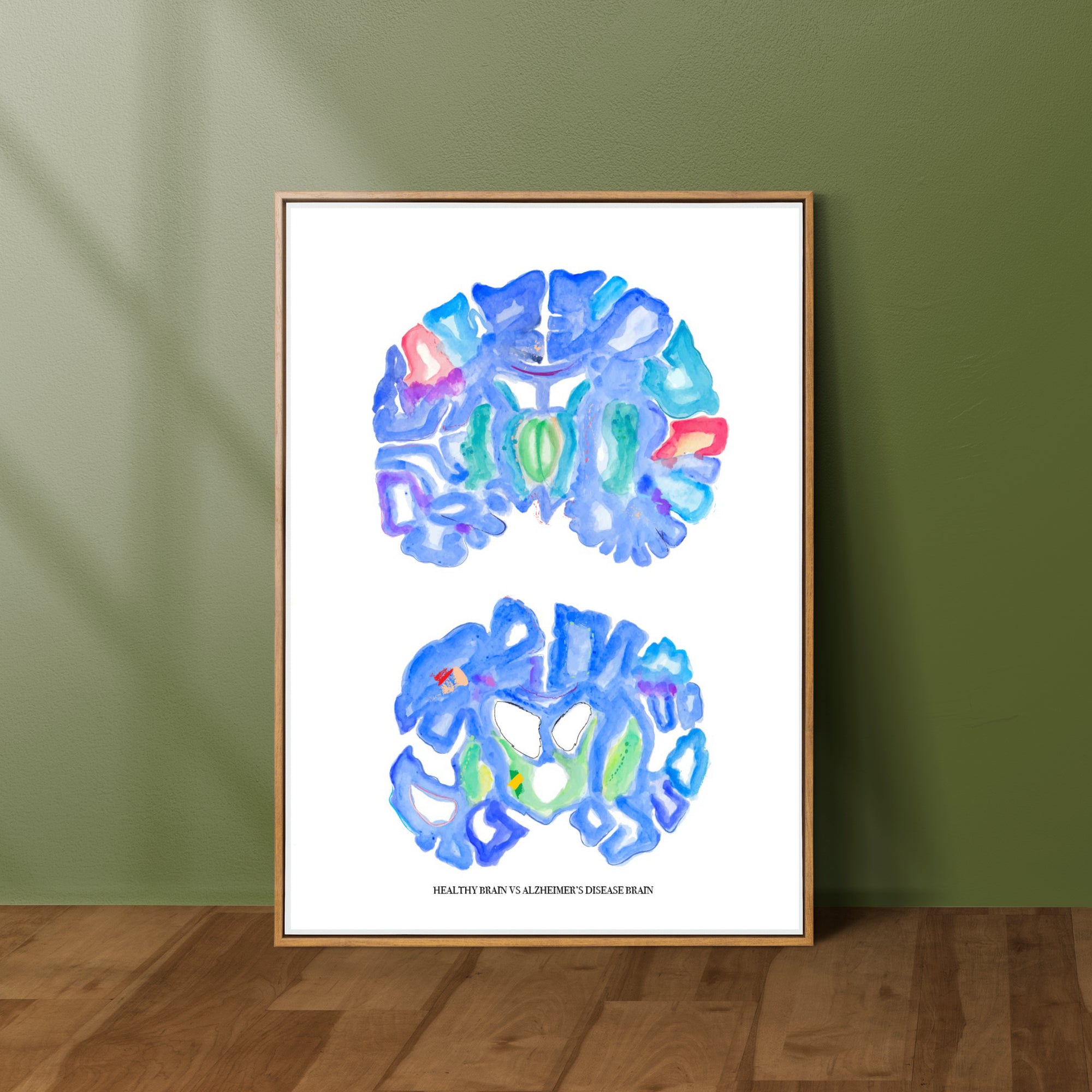alzheimer's brain art
