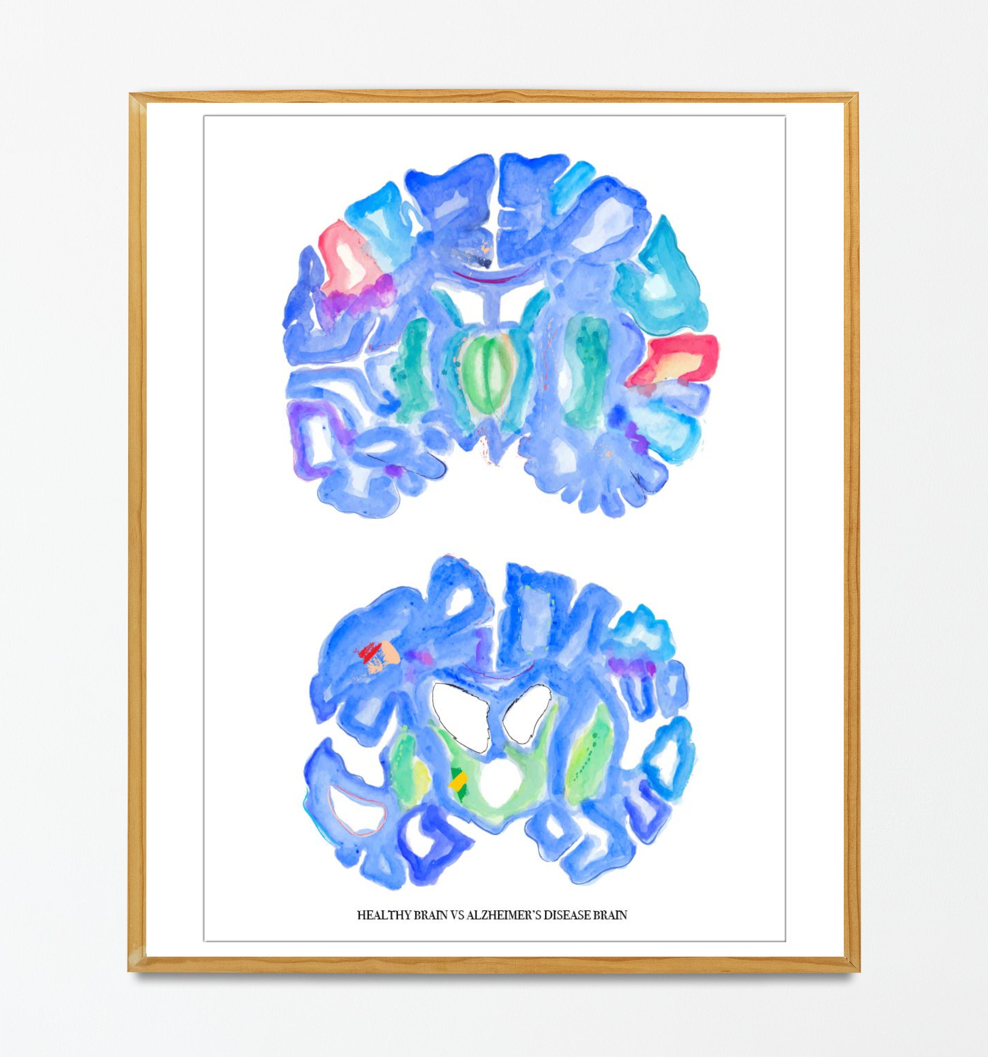 neurology watercolor art