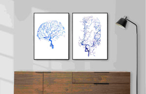brain angiography art print