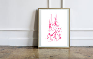 vascular surgery art print