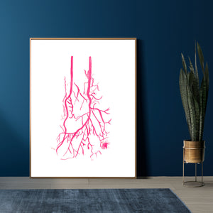 vascular surgery office art