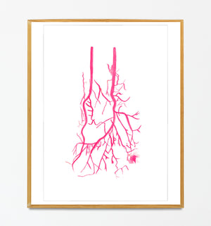 tibial artery