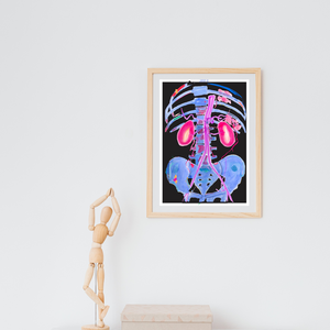 Abdominal CTA Aorta, Kidney Vascular Abstract Anatomy Art Print