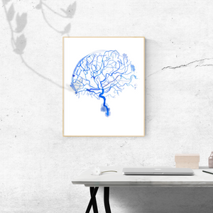 Cerebral Angiography Watercolor Art Print