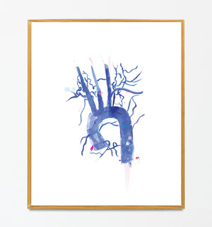 Aorta Anatomy, Cardiology Art Print, Interventional Radiology Wall Art