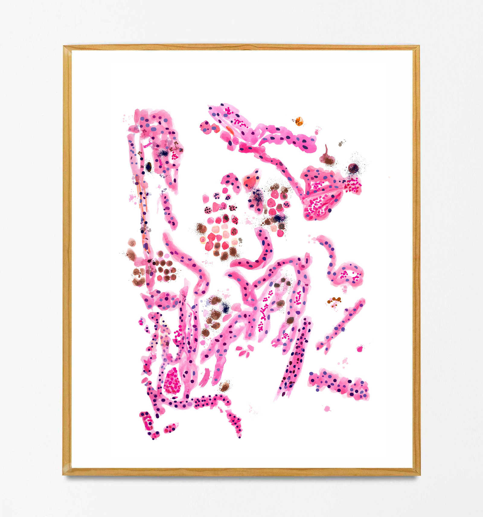 emphysema histopathology art