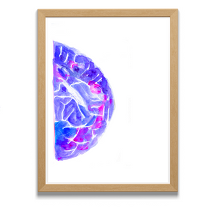 Mammogram Watercolor Art Print