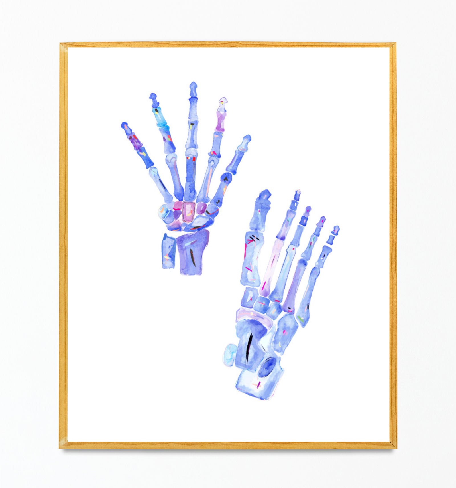 Hand and Foot Anatomy Art, Orthopedic Surgery Print