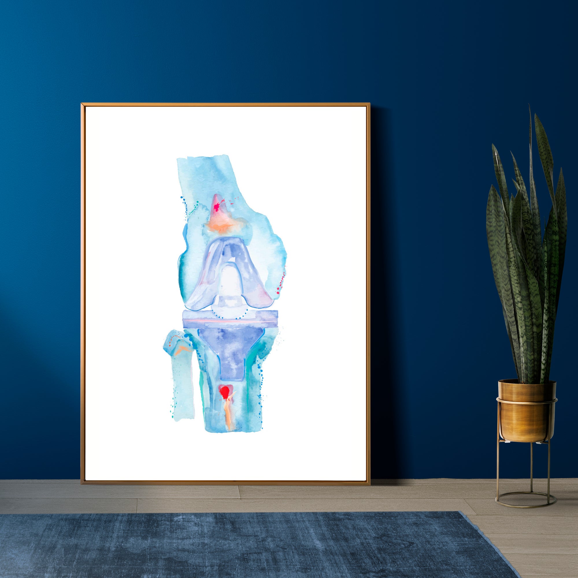 Knee Replacement Surgery Art Print, Orthopedic Surgery Wall Art