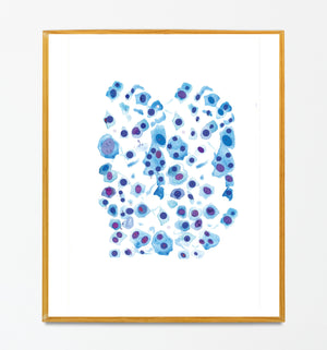 Skin Cell Art Print, Melanoma Art, Dermatology Office Wall Decor, Pathology Art