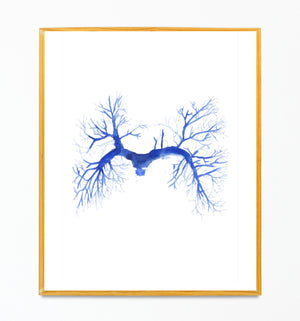 Pulmonary Embolism CT Angiography Watercolor Art Print