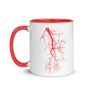 Lower Limb CT Angio in Red Mug