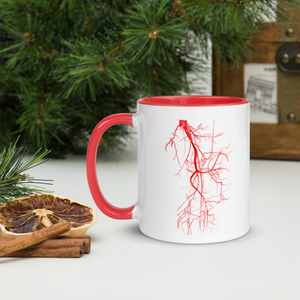 Lower Limb CT Angio in Red Mug