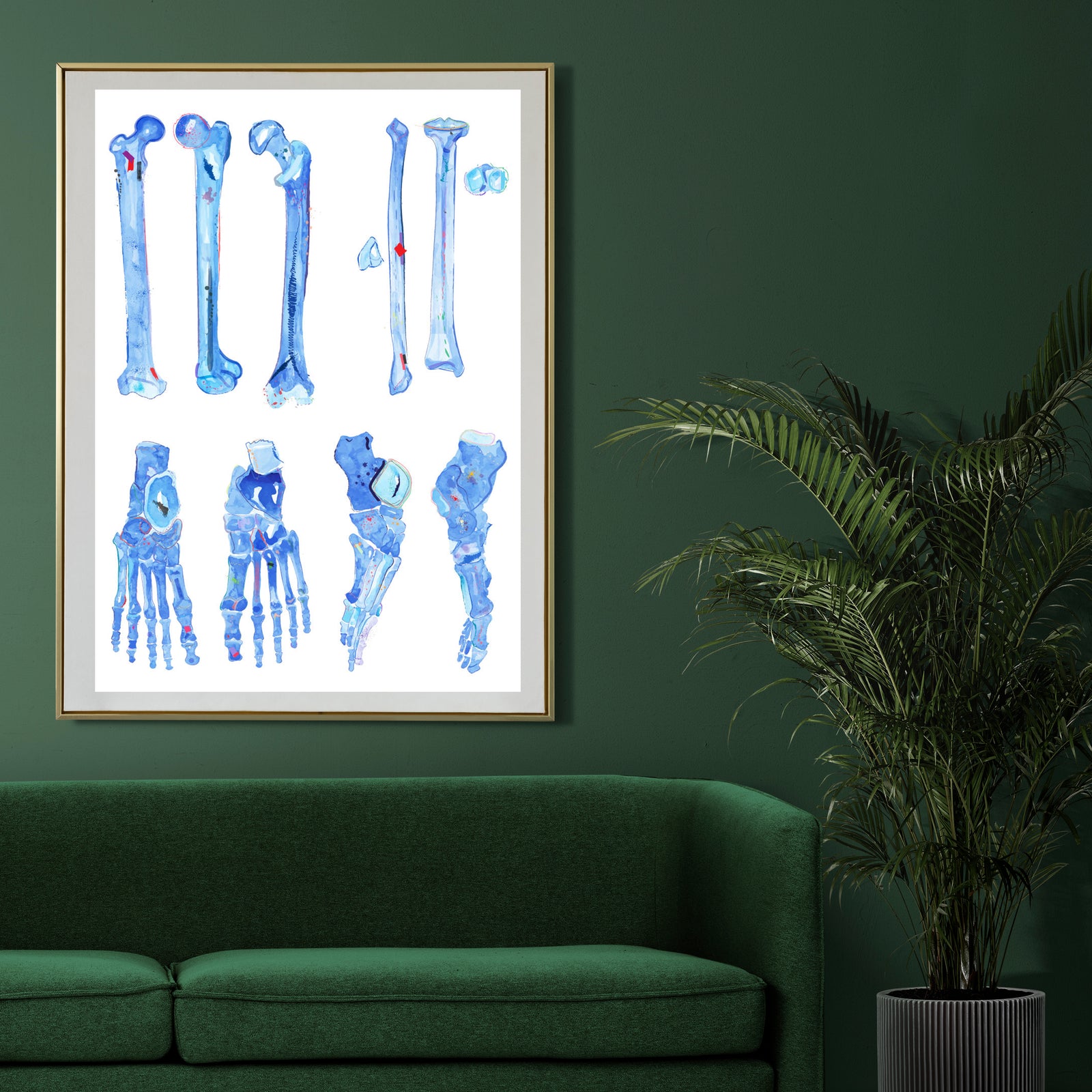 Lower Limb Bones Anatomy Art Print, Orthopedic Surgery Art, Medical Student Art Prnt Gift