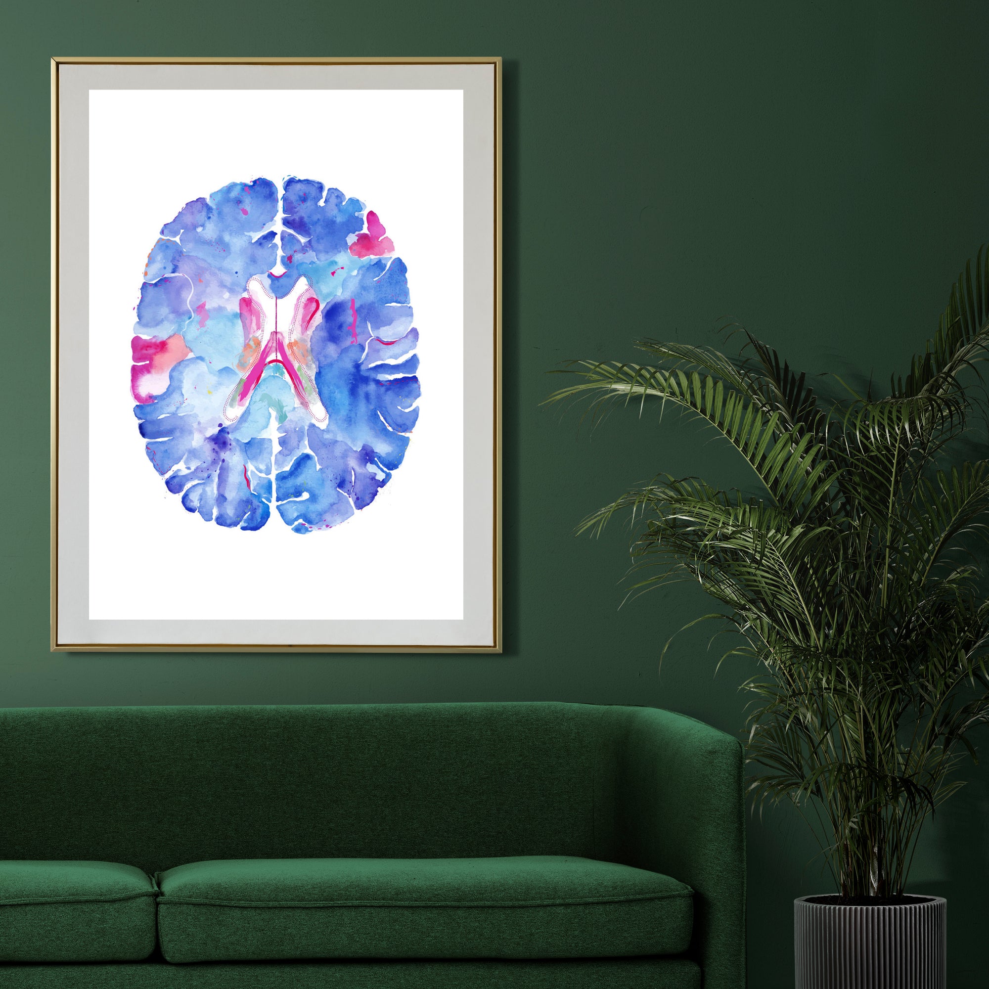 Brain Anatomy Art, Neuroscience Art, Neurologist Gift