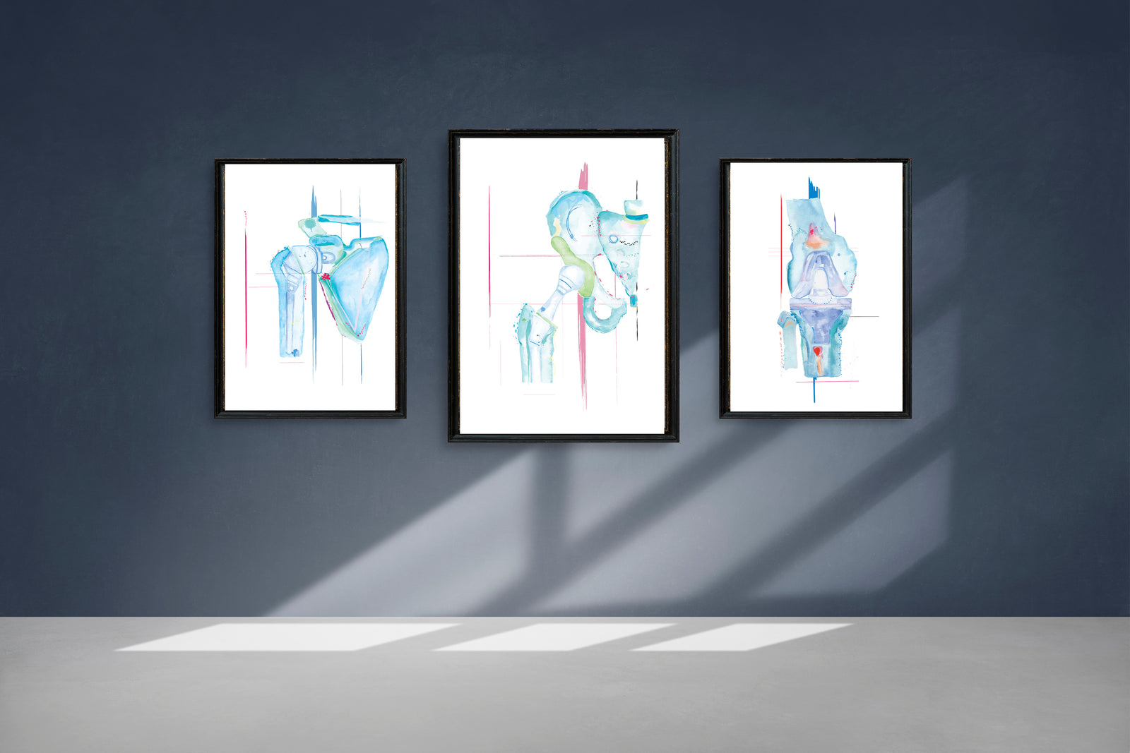 Orthopedic Surgery Artwork Set of Three: Knee, Shoulder and Hip Arthroplasty Print